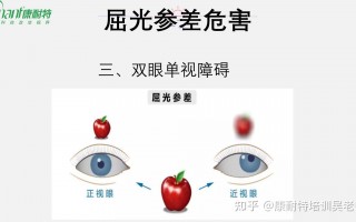 眼睛的度数是怎么样的，眼睛的度数怎么看多少度